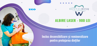 Oferta albire laser