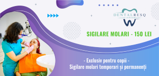 Oferta sigilare molari DentalResQ