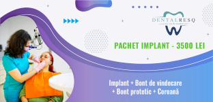 Oferta implant dentar